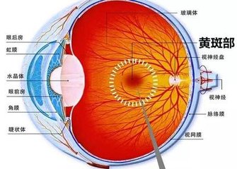 黃斑變性是怎么回事？黃斑變性的方法？