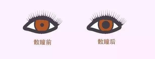 配眼鏡還散瞳，散瞳對眼睛有傷害嗎