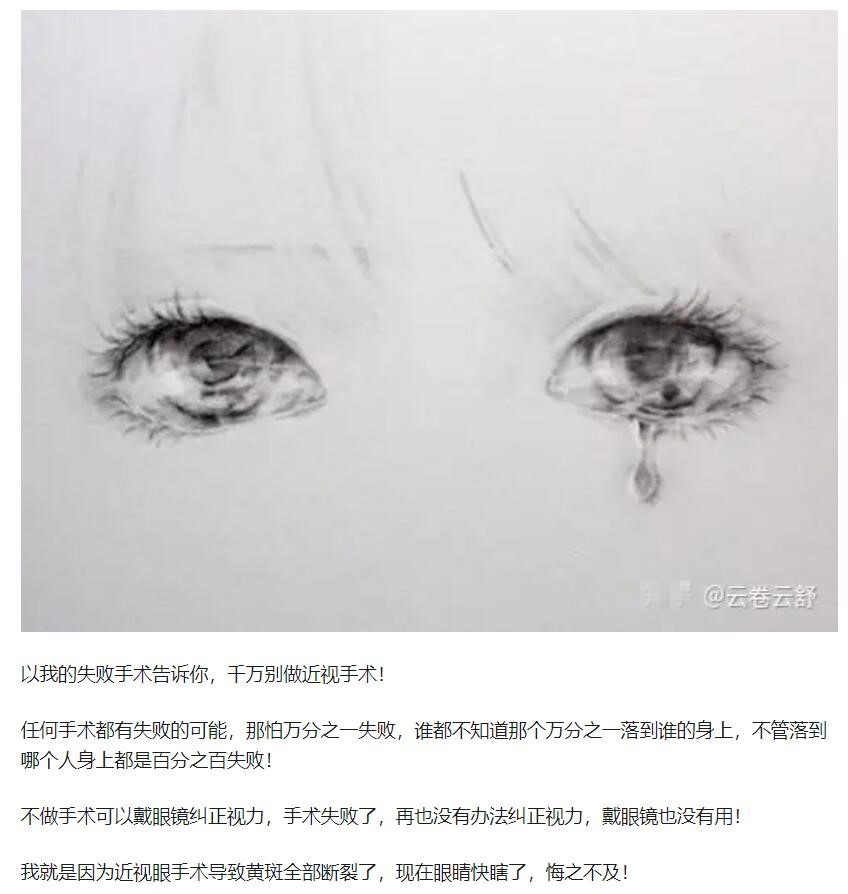 教你，怎樣去了解近視手術(shù)  